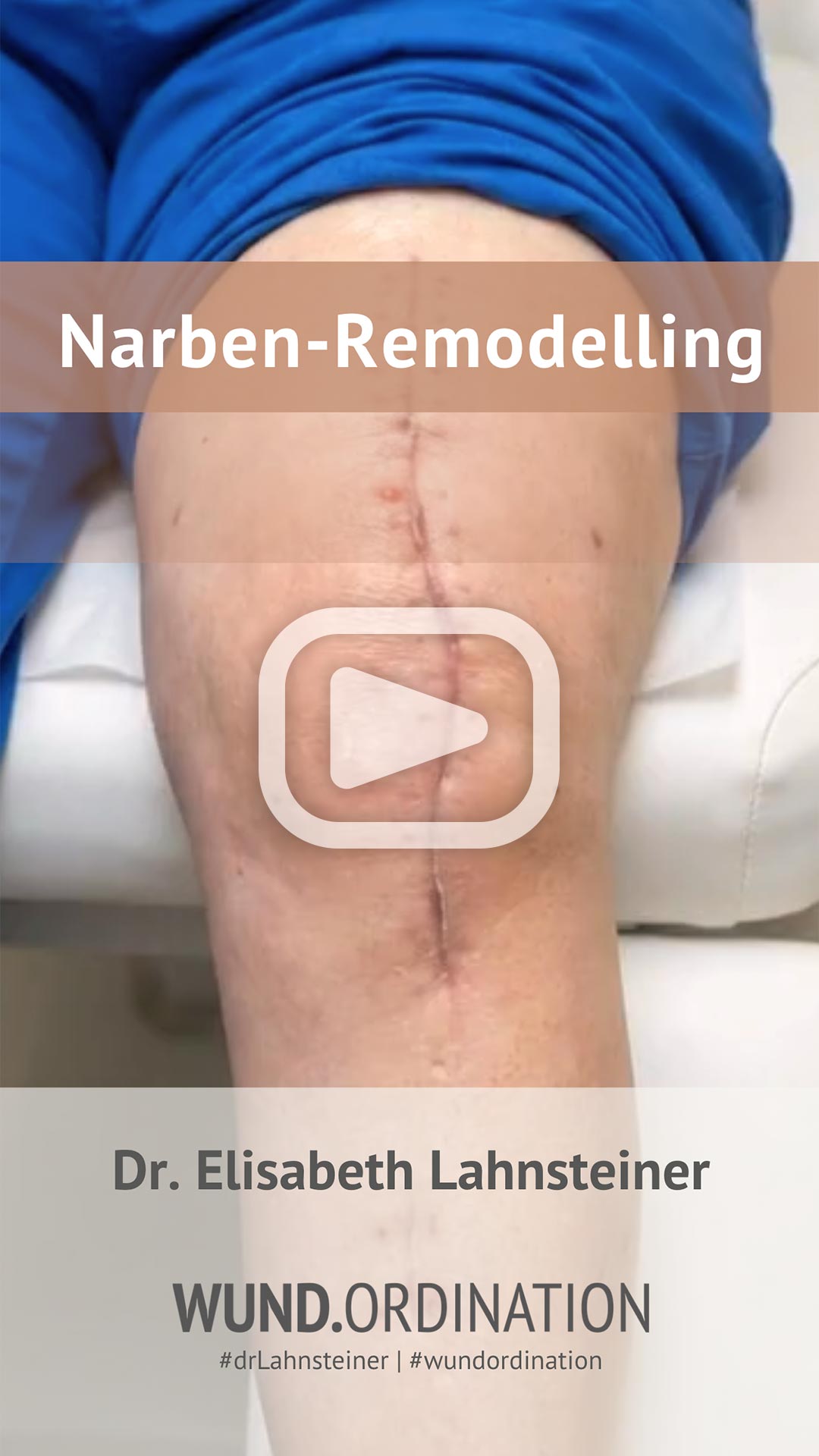 dr. lahnsteiner instagram wundbehandlung narben-remodelling
